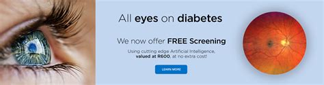 how much is an eye test at specsavers south africa.